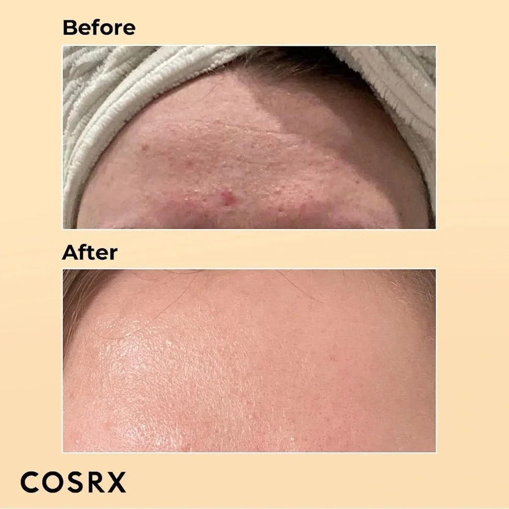 COSRX Advanced Snail 96 Mucin Power Essence 100mL NEW 🐌✨